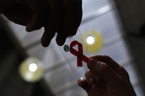 پشتیبانی از توسعه فناوری کیت های تشخیص HIV